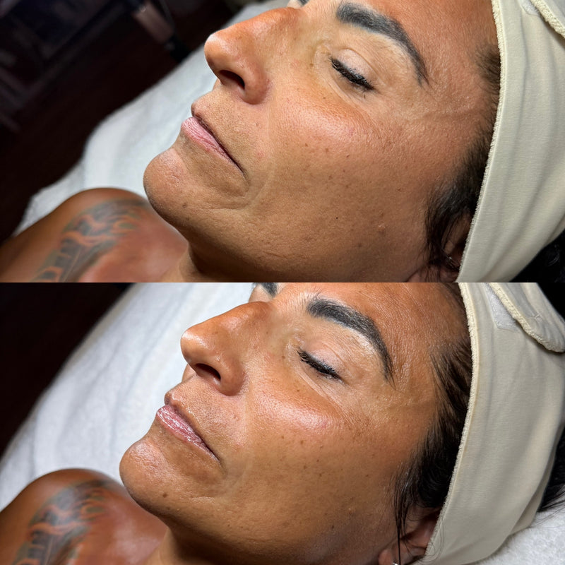 Healthy Glowing skin results from a professional facial treatment at Glow & Grace Skin Studio in Casper, Wyoming.