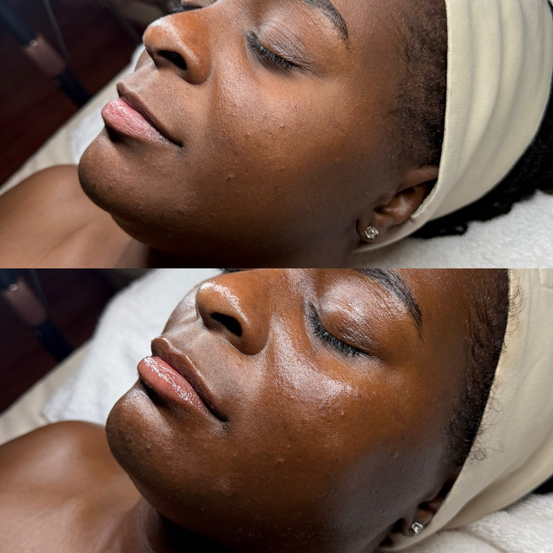 Dermaplaning & 24k Gold facial at Glow & Grace Skin Studio in Casper, Wyoming.