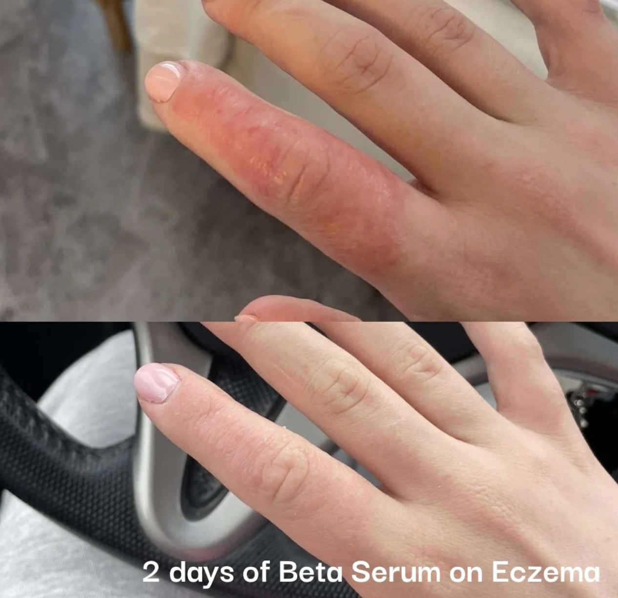 Neogenesis Beta-Glucan Serum